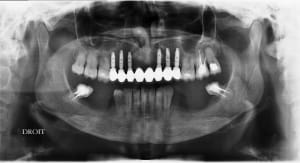 Darcla 17.11 - Eugenol