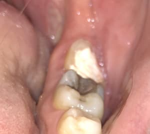 Db514931 a10a 417f 8c94 88001e99fba0 bjl9fi - Eugenol
