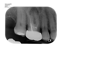 Dbswin hucw2j - Eugenol