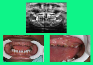 Debut 1 tlipxa - Eugenol