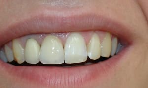 Dsc00379 xqblma - Eugenol