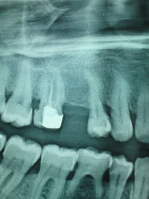 Dsc01264 wphewh - Eugenol