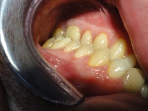 Dsc02742 mcjldi - Eugenol