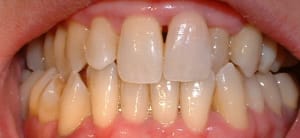 Dscf0009 g5qegg - Eugenol