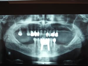 Dscf0332 q4xqjj - Eugenol