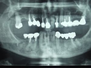 Dscf0335  2  odlctc - Eugenol