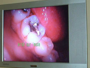 Dscf0688 prwilb - Eugenol