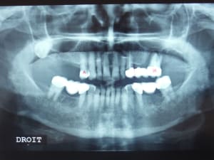 Dscf1044  2  pzszxm - Eugenol