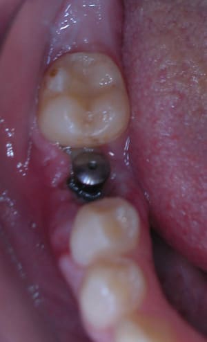 Dscn0410 epijpb - Eugenol