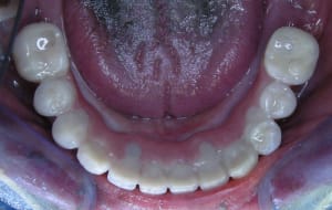 Dscn1506 fcdwjb - Eugenol