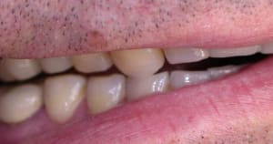 Dscn1942w vxtiwz - Eugenol