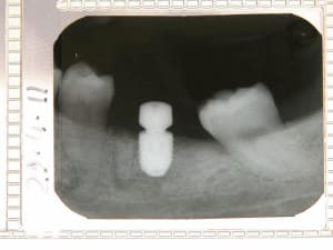 Dscn2376 proper f0xnjx - Eugenol
