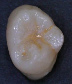 Dscn2458w5 v6ktl9 - Eugenol