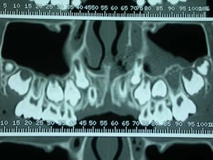 Dscn2557 gkd8bx - Eugenol