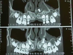 Dscn2563 ln6wfl - Eugenol