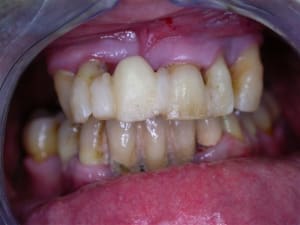 Dscn2620 gnb4kb - Eugenol