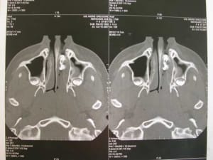 Dscn2654 iktgid - Eugenol