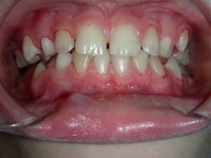 Dscn8299 lhlopa - Eugenol