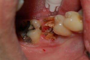 Dsc 0005 icnarv - Eugenol