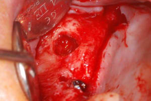 Dsc 0007 eg6xf3 - Eugenol