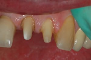 Dsc 0009 jxsegm - Eugenol