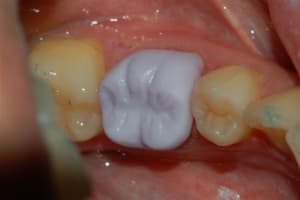 Dsc 0015 m2d4po - Eugenol