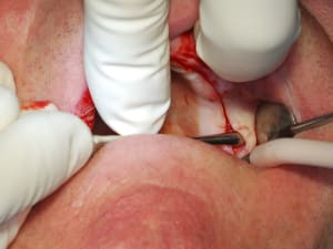 Dsc 0017 tizrtz - Eugenol