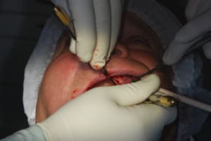 Dsc 0018 kjmmpv - Eugenol