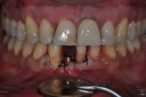 Dsc 0021 xebf3a - Eugenol