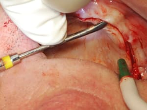 Dsc 0034 m99lxx - Eugenol