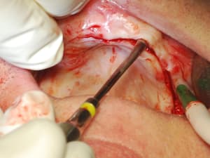 Dsc 0040 bldp3g - Eugenol