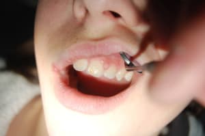 Dsc 0070 mjtwcv - Eugenol