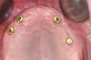 Dsc 0091 habv4h - Eugenol