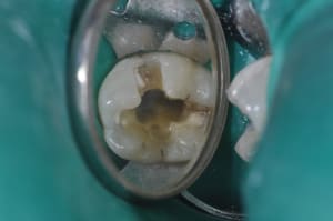 Dsc 0103  2  qlnw88 - Eugenol