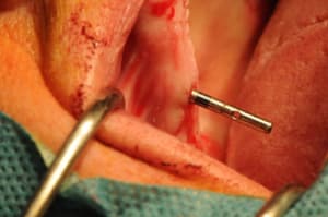 Dsc 0264 kssb87 - Eugenol