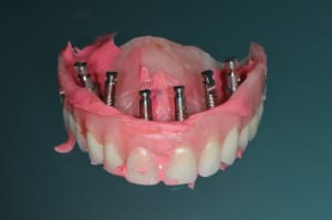 Dsc 0278 clmjej - Eugenol