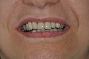 Dsc 0293 eelo63 - Eugenol
