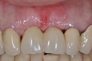 Dsc 0321 cblvsi - Eugenol