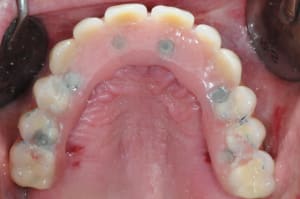 Dsc 0321 dvkint - Eugenol