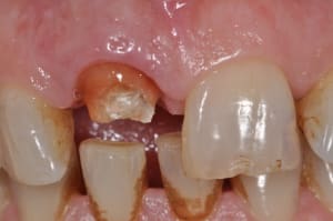 Dsc 0353 tfkf57 - Eugenol