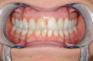 Dsc 0520 uijfsk - Eugenol