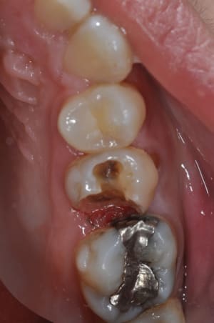 Dsc 0561 tv1mdz - Eugenol