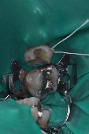Dsc 0572 nskwm4 - Eugenol