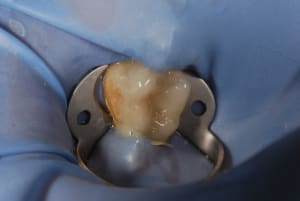 Dsc 0693 ixvwoc - Eugenol