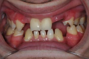 Dsc 0782 d6xswd - Eugenol