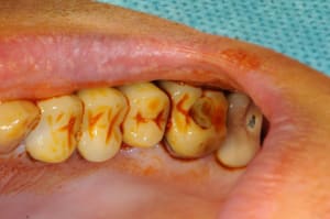 Dsc 1543 csw5ba - Eugenol