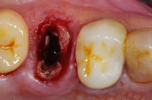 Dsc 1544 fcnp1q - Eugenol