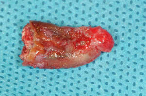 Dsc 1545 rluvlh - Eugenol