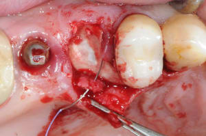 Dsc 1554 p3wkxn - Eugenol