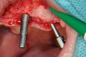 Dsc 1861 bgzqeg - Eugenol
